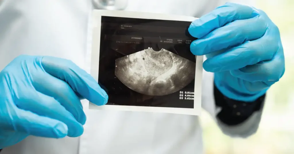 Trust Doctors Centre Hospital for your medical imaging needs, knowing that accurate and detailed diagnostics are crucial for effective healthcare.